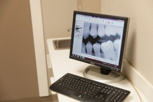 Digital Dental Radiology